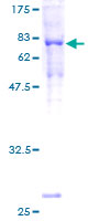 TUBA1B / Tubulin Alpha 1B Protein - 12.5% SDS-PAGE of human TUBA1B stained with Coomassie Blue