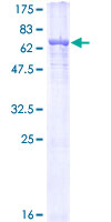 TUBA3C / Tubulin Alpha 3C Protein - 12.5% SDS-PAGE of human TUBA3C stained with Coomassie Blue