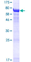 TUBA3E / Tubulin Alpha 3E Protein - 12.5% SDS-PAGE of human TUBA3E stained with Coomassie Blue