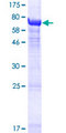 TUBA3E / Tubulin Alpha 3E Protein - 12.5% SDS-PAGE of human TUBA3E stained with Coomassie Blue