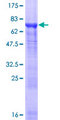 TUBA8 / Tubulin Alpha 8 Protein - 12.5% SDS-PAGE of human TUBA8 stained with Coomassie Blue