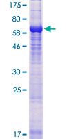 TUBAL3 Protein - 12.5% SDS-PAGE of human TUBAL3 stained with Coomassie Blue
