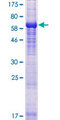 TUBAL3 Protein - 12.5% SDS-PAGE of human TUBAL3 stained with Coomassie Blue