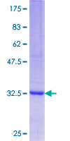 TUBB / Beta Tubulin Protein - 12.5% SDS-PAGE Stained with Coomassie Blue.