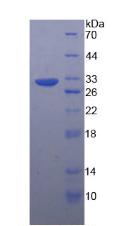 TUBB / Beta Tubulin Protein - Active Tubulin Beta (TUBb) by SDS-PAGE