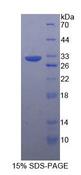 TUBB / Beta Tubulin Protein - Recombinant  Tubulin Beta By SDS-PAGE