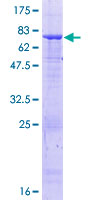 TUBB1 / Tubulin Beta 1 Protein - 12.5% SDS-PAGE of human TUBB1 stained with Coomassie Blue