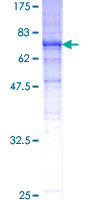 TUBB3 / Tubulin Beta 3 Protein - 12.5% SDS-PAGE of human TUBB3 stained with Coomassie Blue