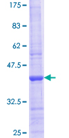 TUBB3 / Tubulin Beta 3 Protein - 12.5% SDS-PAGE Stained with Coomassie Blue.