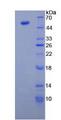 TUBB3 / Tubulin Beta 3 Protein - Recombinant Tubulin Beta 3 By SDS-PAGE