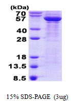 TUBB3 / Tubulin Beta 3 Protein