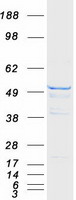TUBB3 / Tubulin Beta 3 Protein - Purified recombinant protein TUBB3 was analyzed by SDS-PAGE gel and Coomassie Blue Staining