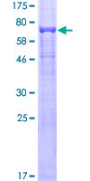 TUBB4 / Tubulin Beta 4 Protein - 12.5% SDS-PAGE of human TUBB4 stained with Coomassie Blue