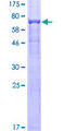 TUBB4 / Tubulin Beta 4 Protein - 12.5% SDS-PAGE of human TUBB4 stained with Coomassie Blue