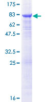 TUBB6 / Tubulin Beta 6 Protein - 12.5% SDS-PAGE of human TUBB6 stained with Coomassie Blue