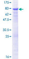 TUBB6 / Tubulin Beta 6 Protein - 12.5% SDS-PAGE of human TUBB6 stained with Coomassie Blue