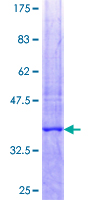 TUBD1 / Tubulin Delta Protein - 12.5% SDS-PAGE Stained with Coomassie Blue.