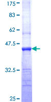 Tuberin / TSC2 Protein - 12.5% SDS-PAGE Stained with Coomassie Blue.