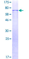 TUBG1 / Tubulin Gamma 1 Protein - 12.5% SDS-PAGE of human TUBG1 stained with Coomassie Blue