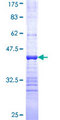 TUBG2 / Tubulin Gamma 2 Protein - 12.5% SDS-PAGE Stained with Coomassie Blue.