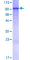 TUBGCP4 Protein - 12.5% SDS-PAGE of human TUBGCP4 stained with Coomassie Blue