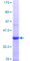 TUBGCP5 / GPC5 Protein - 12.5% SDS-PAGE Stained with Coomassie Blue.