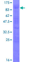 TULP1 Protein - 12.5% SDS-PAGE of human TULP1 stained with Coomassie Blue