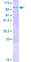 TULP2 Protein - 12.5% SDS-PAGE of human TULP2 stained with Coomassie Blue