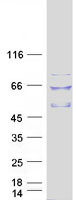 TULP2 Protein - Purified recombinant protein TULP2 was analyzed by SDS-PAGE gel and Coomassie Blue Staining