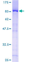 TULP3 Protein - 12.5% SDS-PAGE of human TULP3 stained with Coomassie Blue