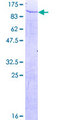 TULP4 Protein - 12.5% SDS-PAGE of human TULP4 stained with Coomassie Blue
