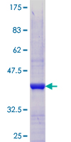 TULP4 Protein - 12.5% SDS-PAGE Stained with Coomassie Blue.