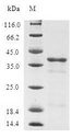 TUSC2 / FUS1 Protein - (Tris-Glycine gel) Discontinuous SDS-PAGE (reduced) with 5% enrichment gel and 15% separation gel.