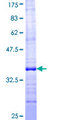 TUSC2 / FUS1 Protein - 12.5% SDS-PAGE Stained with Coomassie Blue.