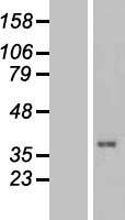 TUSC3 Protein - Western validation with an anti-DDK antibody * L: Control HEK293 lysate R: Over-expression lysate