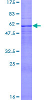TUSC3 Protein - 12.5% SDS-PAGE of human TUSC3 stained with Coomassie Blue