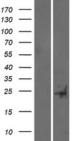 TUSC5 Protein - Western validation with an anti-DDK antibody * L: Control HEK293 lysate R: Over-expression lysate