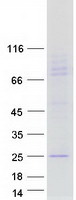 TUSC5 Protein - Purified recombinant protein TUSC5 was analyzed by SDS-PAGE gel and Coomassie Blue Staining