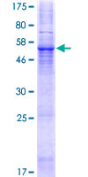 TVP23C Protein - 12.5% SDS-PAGE of human FAM18B2 stained with Coomassie Blue