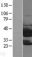 TWF1 / PTK9 Protein - Western validation with an anti-DDK antibody * L: Control HEK293 lysate R: Over-expression lysate