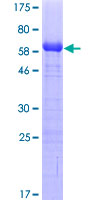 TWF1 / PTK9 Protein - 12.5% SDS-PAGE of human PTK9 stained with Coomassie Blue