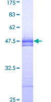 TWF1 / PTK9 Protein - 12.5% SDS-PAGE Stained with Coomassie Blue.