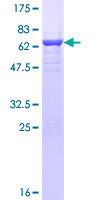 TWF2 / PTK9L Protein - 12.5% SDS-PAGE of human PTK9L stained with Coomassie Blue