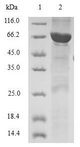 TWF2 / PTK9L Protein - (Tris-Glycine gel) Discontinuous SDS-PAGE (reduced) with 5% enrichment gel and 15% separation gel.