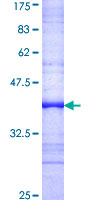 TWF2 / PTK9L Protein - 12.5% SDS-PAGE Stained with Coomassie Blue.
