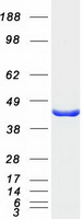 TWF2 / PTK9L Protein - Purified recombinant protein TWF2 was analyzed by SDS-PAGE gel and Coomassie Blue Staining
