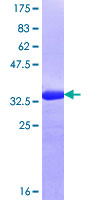 TWIK1 / KCNK1 Protein - 12.5% SDS-PAGE Stained with Coomassie Blue.