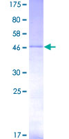 TWIST1 / TWIST Protein - 12.5% SDS-PAGE of human TWIST1 stained with Coomassie Blue
