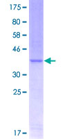 TWIST1 / TWIST Protein - 12.5% SDS-PAGE Stained with Coomassie Blue.