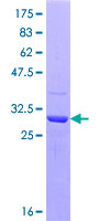 TWIST1 / TWIST Protein - 12.5% SDS-PAGE Stained with Coomassie Blue.